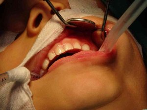 Bölgenin Diş Sağlığı Bu Hastaneye Emanet