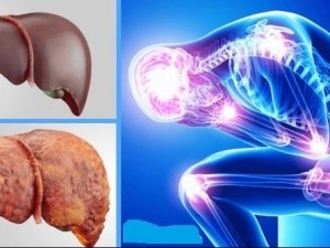 Karaciğer Nakilleri Arttı, Hastalık Önlenebilir