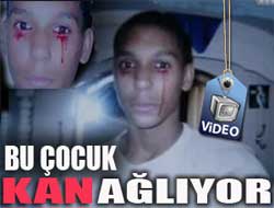 Yaş yerine KAN ağlıyor