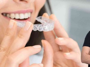 Şeffaf Plak Tedavisi İle Estetik Bir Gülüşe Sahip Olmak Artık Daha Kolay