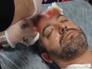 Avukata Beyzbol Sopalı Saldırıda Bulunan Sanık İlk Celsede Tahliye Edildi