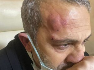 Şanlıurfa’da Hasta Yakınları Sağlık Çalışanını Darp Etti