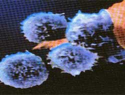 AIDS tarihe karışacak