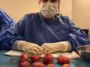 Bursa’da Hastanın Rahminden 21 Miyom Çıkarıldı