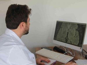 Beyin Cerrahisi ’Parkinson’a Tedavi İmkanı Sunuyor