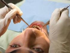 Diş de özele sevk kaldırıldı