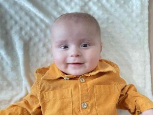 200 Binde Bir Görülen Hastalıkla Doğan Bebek Annesinin Karaciğeri İle Hayata Tutundu