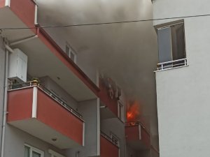 Çocuğun Çakmakla Oyunu Kötü Bitti