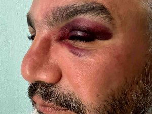 Eşinin Memleketini Tanımak İsteyen Gurbetçi, Trafik Magandalarının Kurbanı Oldu