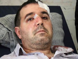 ‘Beni Taciz, Rahatsız Ediyorsun’ Diyerek Saldırdığı Aile Hekiminin Burnunu Kırdı