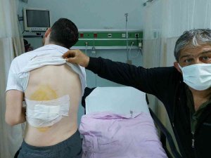 Ankara’dan Bayram İçin Geldiği Samsun’da Sokak Köpeğinin Saldırısına Uğradı