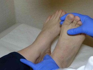 Uzmanı Uyardı: Dar Ayakkabı Düztabanlık Ve Mantar Enfeksiyonu Nedeni