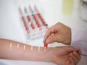 Alerjiyi hafife almayın, test yaptırın!