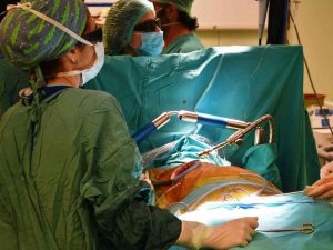 Üç Boyutlu Görüntüleme İle 4 Santimlik Kesiden Kalp Kapağı Ameliyatı