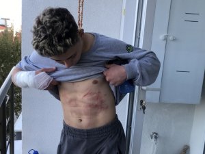 Kayalıklardan Denize Atladı, Boğulmanın Eşiğine Geldi