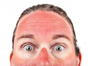 "Bronzlaşma Aslında Derinin Kendini Koruma Mekanizmasıdır"