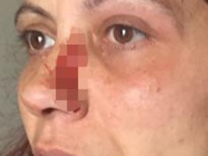Büyükçekmece’de Sitede Kadına Darp İddiası
