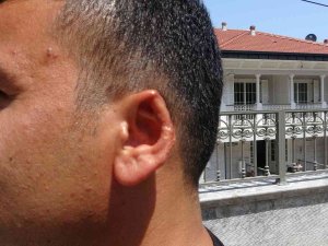 Film Senaryolarını Aratmayacak Olay: Kavgada Kopan Kulağını Martı Kaptı