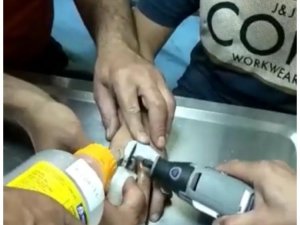 Çocuğun Parmağına Sıkışan Metal Somunu İtfaiye Çıkarttı