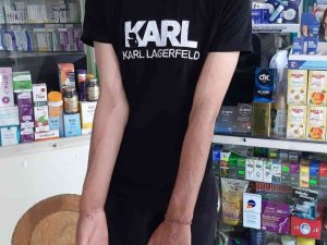 Sultangazi’de “Maymun Çiçeği” İddiası Korkuttu