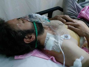 İ̇nşaat Ustasının Omzuna İsabet Eden Yorgun Mermi Ağır Yaraladı