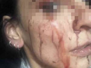Esenyurt’ta Site İçerisinde Alkol Aldığı İddia Edilen Kadınları Tekme Tokat Dövdüler