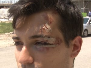 Bisikletiyle Üniversiteye Giden Öğrenci Sokak Köpeklerinin Saldırısına Uğradı