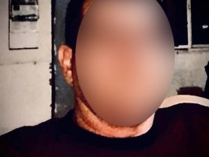 Çalışanı Tarafından Bıçaklanıp Yakılan Patron Hastanede Yaşam Mücadelesi Veriyor