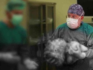 Kadın Hastanın Karnından 16,9 Kiloluk Dev Kitle Çıktı, 40 Yıllık Doktor Bile Şaşırdı