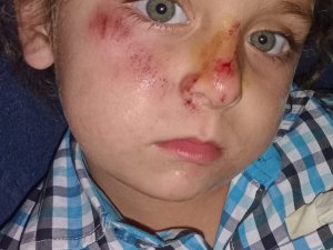 Sokak Köpeği, Sırtından Isırdığı Çocuğu Yüz Üstü Sürükledi