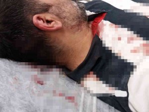 Büyükada’da Kaçak İnşaatı Görüntülemek İsteyen Gazeteciye Kazma Kürek İle Saldırdılar
