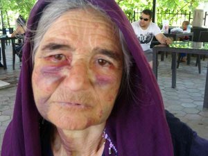 Kuzusunu Sürüden Almak İsterken Dayak Yedi, Yüzü Tanınmaz Hale Geldi