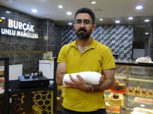 Kadını Kurtarmak İsterken Hem Ayağından Isırıldı Hem De Kolunu Kırdı