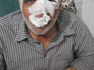 Gaziantep’te Köpeklerin Saldırdığı 1 Kişi Öldü