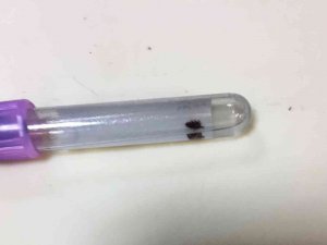 Vücuduna Yapışan Kene Acil Serviste Çıkarıldı