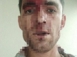 Nevşehir’de Komşu Dehşeti