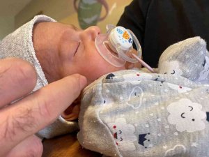 40 Bin Doğumda Bir Görülen Hastalığa Yakalanan Bebek Başarıyla Tedavi Edildi