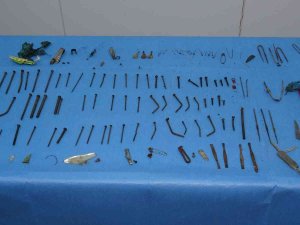 Doktorları Şaşkına Çeviren Ameliyat: Midesinden 158 Parça Metal Çıktı