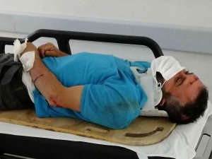 Seyir Halindeki Motosikletten Düşen Yolcu Yaralandı