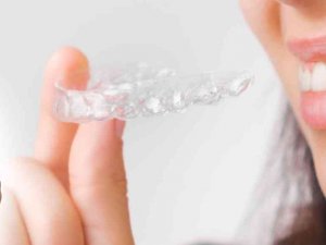 Şeffaf Plakla Dişler Simetrik Bir Görüntüye Kavuşuyor