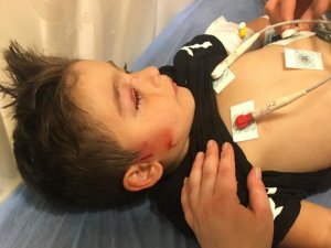 Köpeklerin Saldırdığı 3 Yaşındaki Çocuğun Yüzü Parçalandı