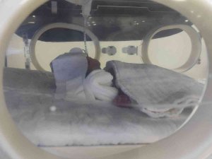 Helikopter Ambulansla Şanlıurfa’ya Getirilen 775 Gramlık Bebeğin Tedavisi Sürüyor