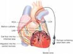 Beta, Kalp Kapakçığı Hastalığı Yapabilir