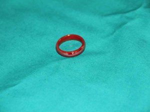 Oyun Oynarken Yerdeki Yüzüğü Yutan 3 Yaşındaki Çocuk Ölümden Döndü