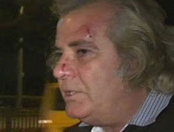 Tarık Akan'a sokakta coplu saldırı