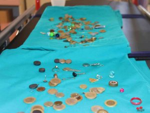 Para, Pul, İğne, Yüzük: Bu Midelerde Ne Ararsanız Var