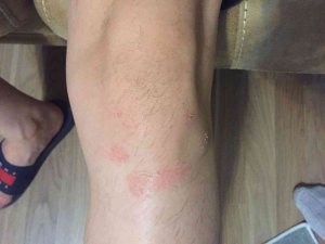 "Gazi Polise Yumruk Attı, Polis Gaziye Karakolda İşkence Yaptı" İddiası