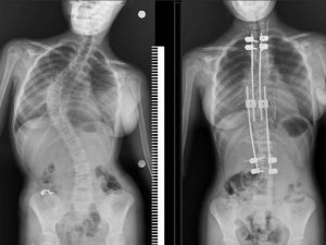 500 Bin Liralık Ameliyatı 1 Kuruş Vermeden Oldu