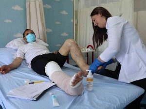 Fil Hastalığına Masajlı Tedavi