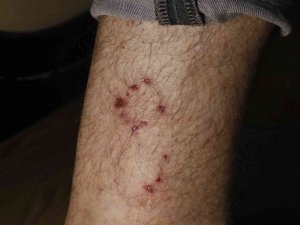 Ailesiyle Evine Giderken Köpeklerin Saldırısına Uğradı